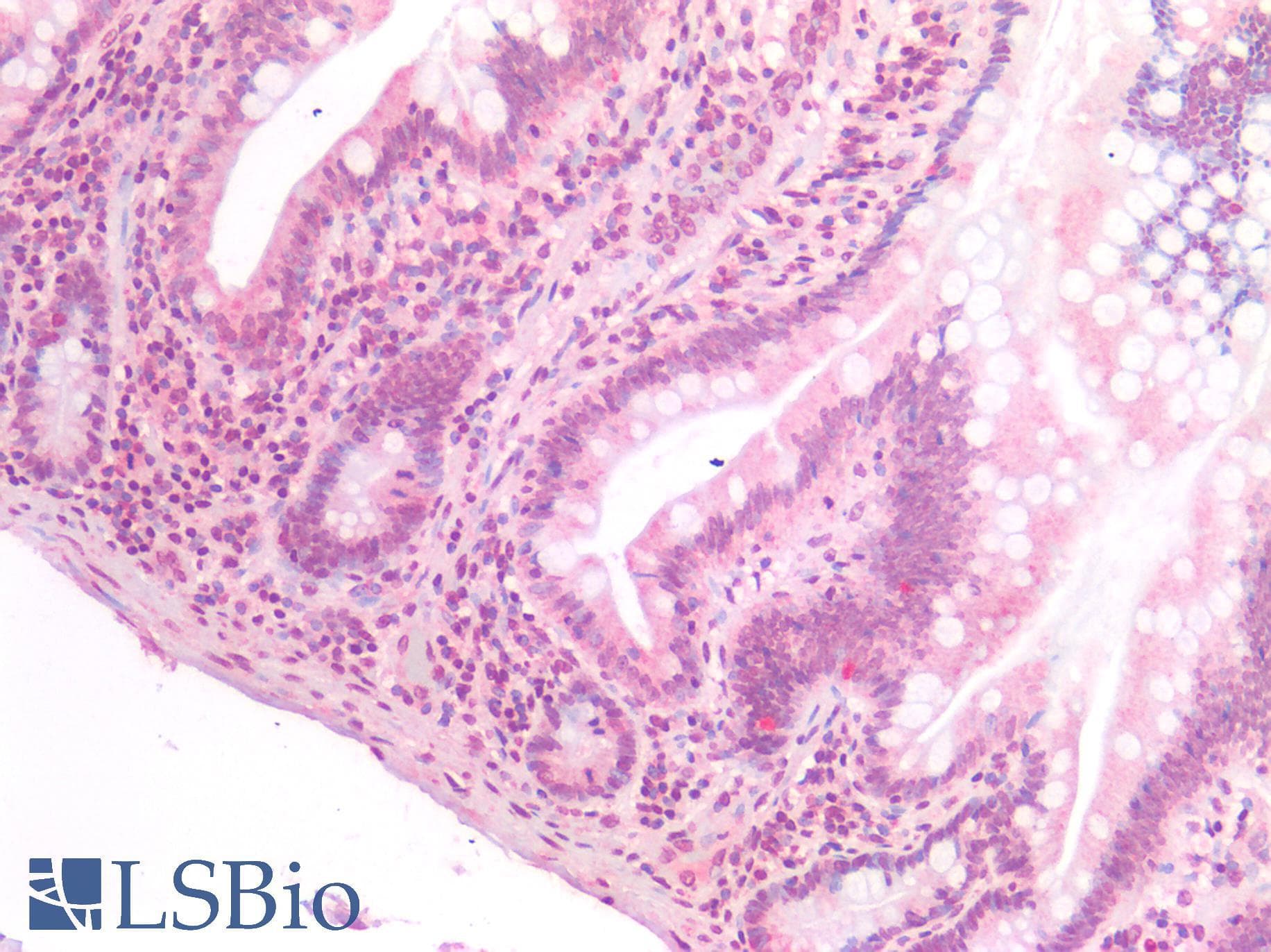 PathPlus™ SIAH2 Antibody