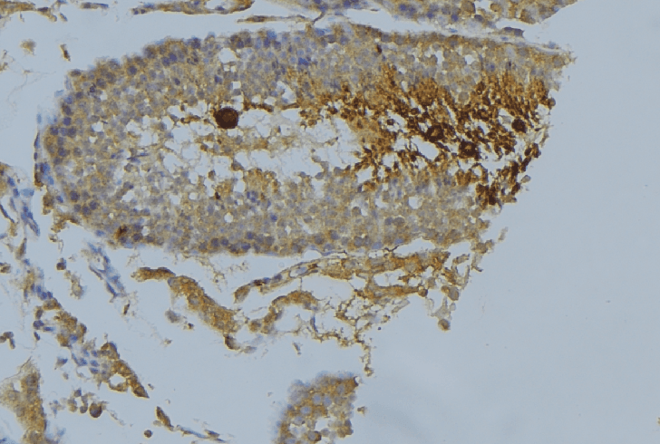 ADD1 / Adducin Alpha Antibody