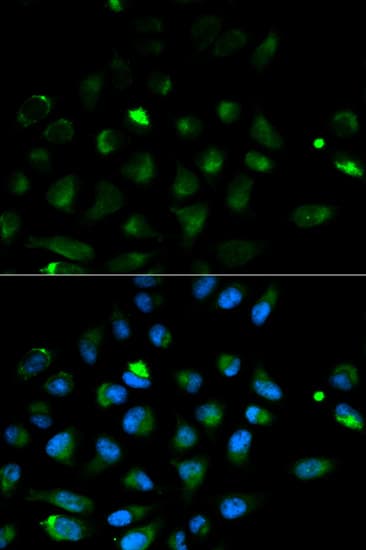 Polyclonal Rabbit anti-Human PRF1 / Perforin Antibody (IHC, IF, WB)