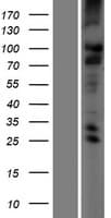 TMC2 Protein (Over-Expression Lysate Myc-DDK (Flag))