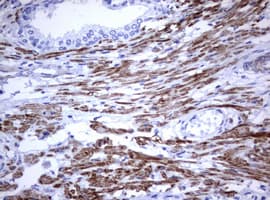 Monoclonal Mouse anti-Human CD30 Antibody (clone OTI9H7, IHC, WB)