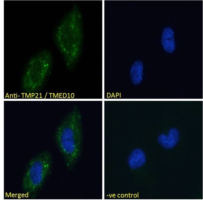 TMED10 / TMP21 Antibody (aa207-219)