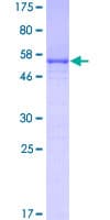 Human FRG1 Protein (Recombinant GST)