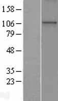 WDR36 Protein (Over-Expression Lysate Myc-DDK (Flag))