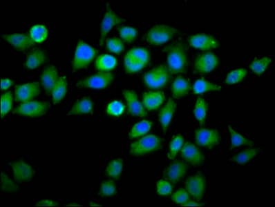 WDFY2 Antibody