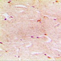 ACTG2 Antibody (N-Terminus)