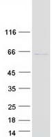 Human TGM2 / Transglutaminase 2 Protein (Recombinant Myc-DDK (Flag))