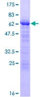 Human TMOD1 / Tropomodulin 1 Protein (Recombinant GST)