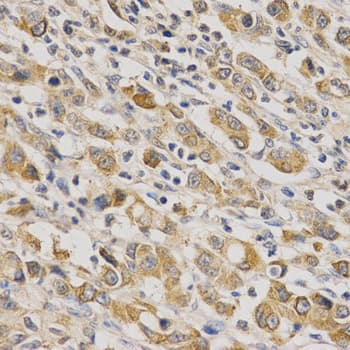 Polyclonal Rabbit anti-Human ERG Antibody (IHC, IF, WB)