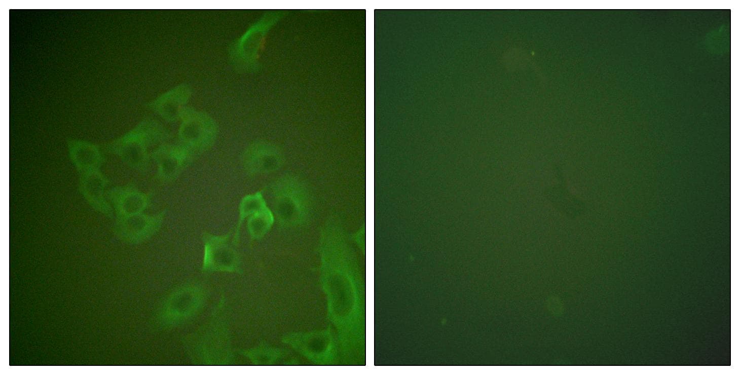 SNCB / Beta-Synuclein Antibody