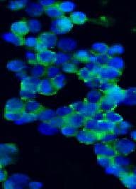 PathPlus™ NCAM / CD56 Antibody (clone 123C3)
