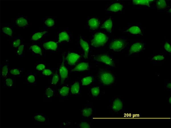 TFAP4 / AP-4 Antibody (clone 6B1)