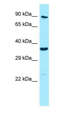 Polyclonal Rabbit anti-Human MPP4 / Discs Large Homolog 6 Antibody (aa434-483, WB)