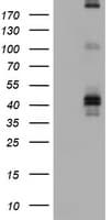 FCER2 / CD23 Antibody (aa48-321, clone OTI1E5)