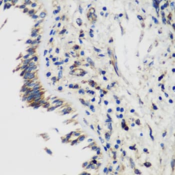 Polyclonal Rabbit anti-Human SMYD1 Antibody (IHC, IF, WB)