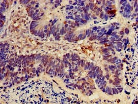 NOD2 / CARD15 Antibody