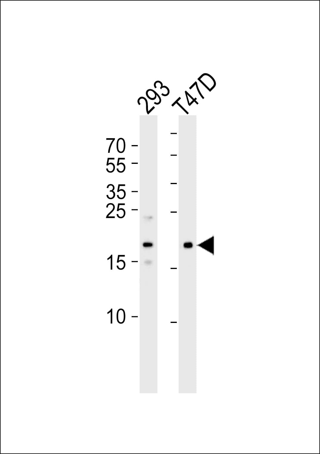 Polyclonal Rabbit anti-Human MAP1LC3C / LC3C Antibody (aa1-30, IHC, WB)
