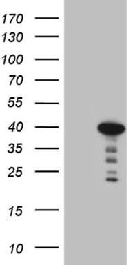 Myozenin / MYOZ1 Antibody (aa106-299, clone OTI7E9)