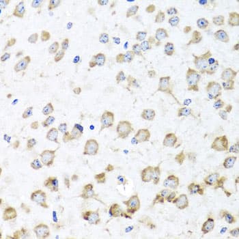Polyclonal Rabbit anti-Human RPL36 / Ribosomal Protein L36 Antibody (IHC, WB)