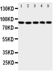 ALOX5 / 5-LOX Antibody (aa650-667)