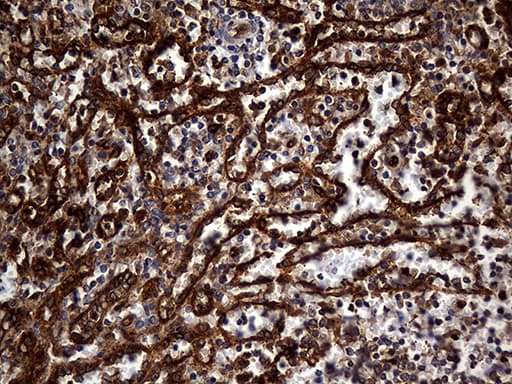 Monoclonal Mouse anti-Human CPM / Carboxypeptidase M Antibody (clone OTI4E11, aa124-423, IHC, WB)