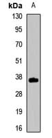 TSPAN7 / CD231 Antibody
