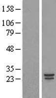 COMMD5 Protein (Over-Expression Lysate Myc-DDK (Flag))