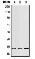 Polyclonal Rabbit anti-Human RPS18 / Ribosomal Protein S18 Antibody (Internal, WB)