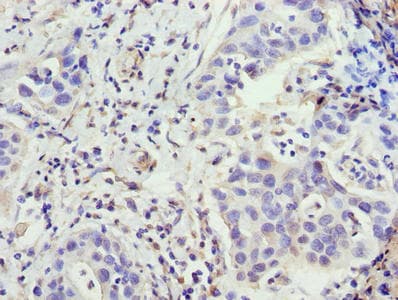 ZNF643 Antibody