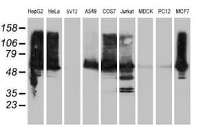 ILVBL Antibody (clone OTI8B12)