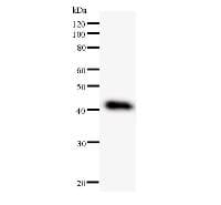 DDX27 Antibody (clone 2251C2a)