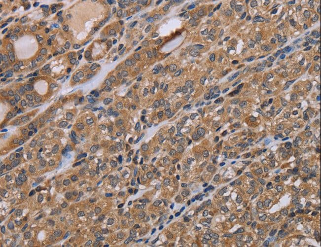 NAA25 Antibody