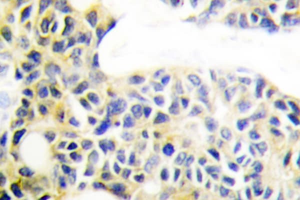 KRT18 / CK18 / Cytokeratin 18 Antibody (Ser48)