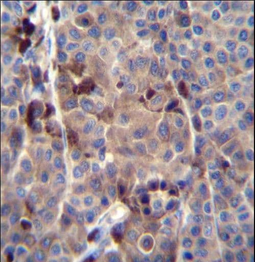 PRAMEF8 Antibody (aa419-447)