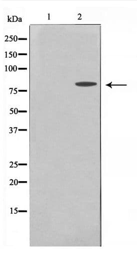 Polyclonal Rabbit anti-Human MMP15 Antibody (WB)