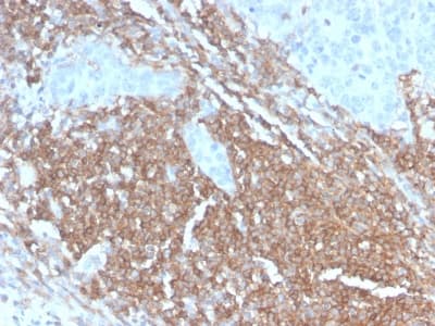 CD45RB Antibody (clone PTPRC/2877R, Azide-free, Carrier-free)