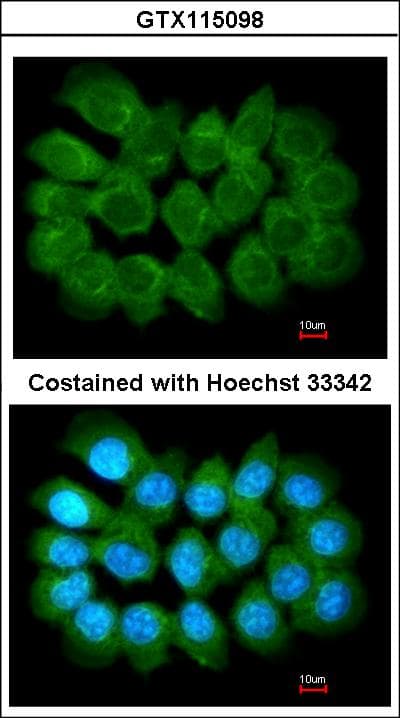 Polyclonal Rabbit anti-Human PPFIA1 / LIPRIN Antibody (aa18-277, WB)