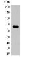 Polyclonal Rabbit mCherry Tag Antibody (WB)