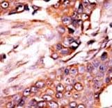 Polyclonal Rabbit anti-Human ALK2 / ACVR1 Antibody (aa6-34, IHC, WB)