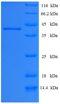 Epstein-Barr Virus BALF5 Protein (Recombinant His-SUMO)