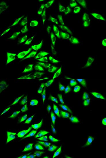 STI1 / STIP1 Antibody
