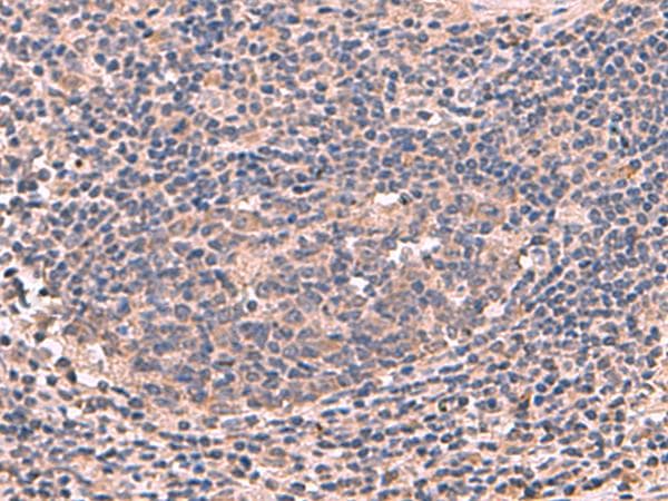 Polyclonal Rabbit anti-Human MAGEC2 / CT10 Antibody (IHC, WB)