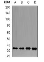 Polyclonal Rabbit anti-Human PPP1CB Antibody (IHC, IF, WB)