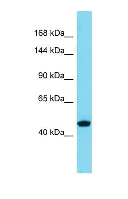 Polyclonal Rabbit anti-Human SLC39A10 / ZIP10 Antibody (aa62-111, WB)