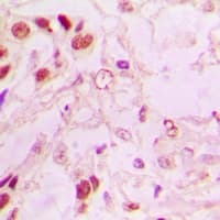 MDM2 Antibody (C-Terminus)