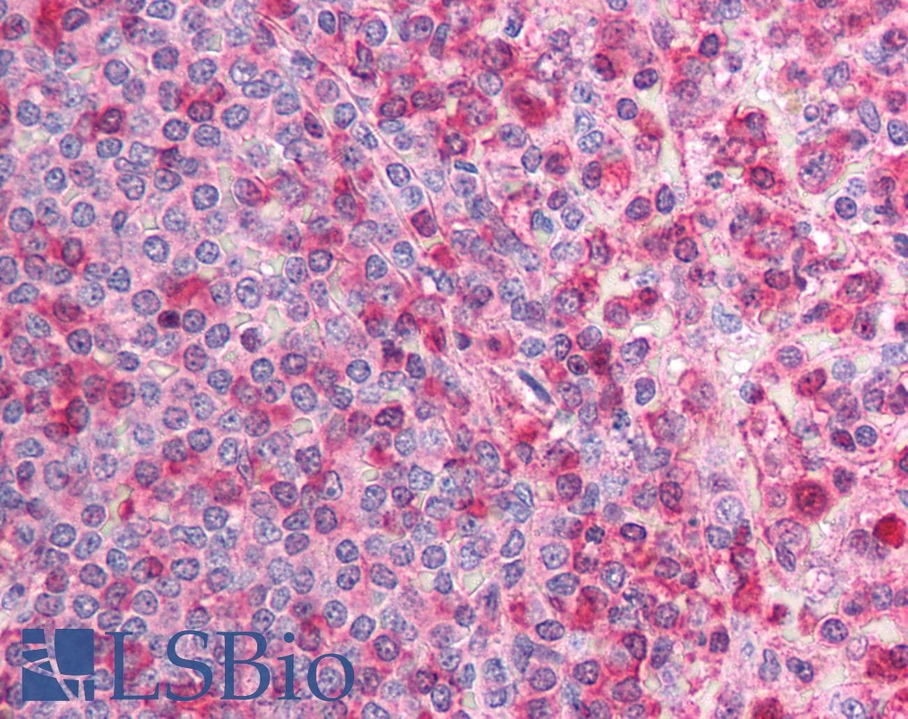 CACNB2 Antibody (N-Terminus)