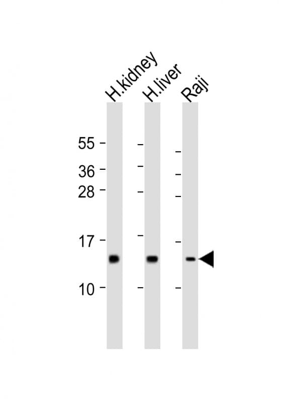 Polyclonal Rabbit anti-Human NDUFS5 Antibody (aa5-36, WB)