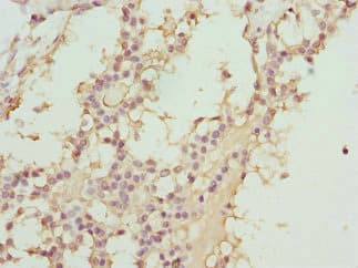 ABCC11 / MRP8 Antibody