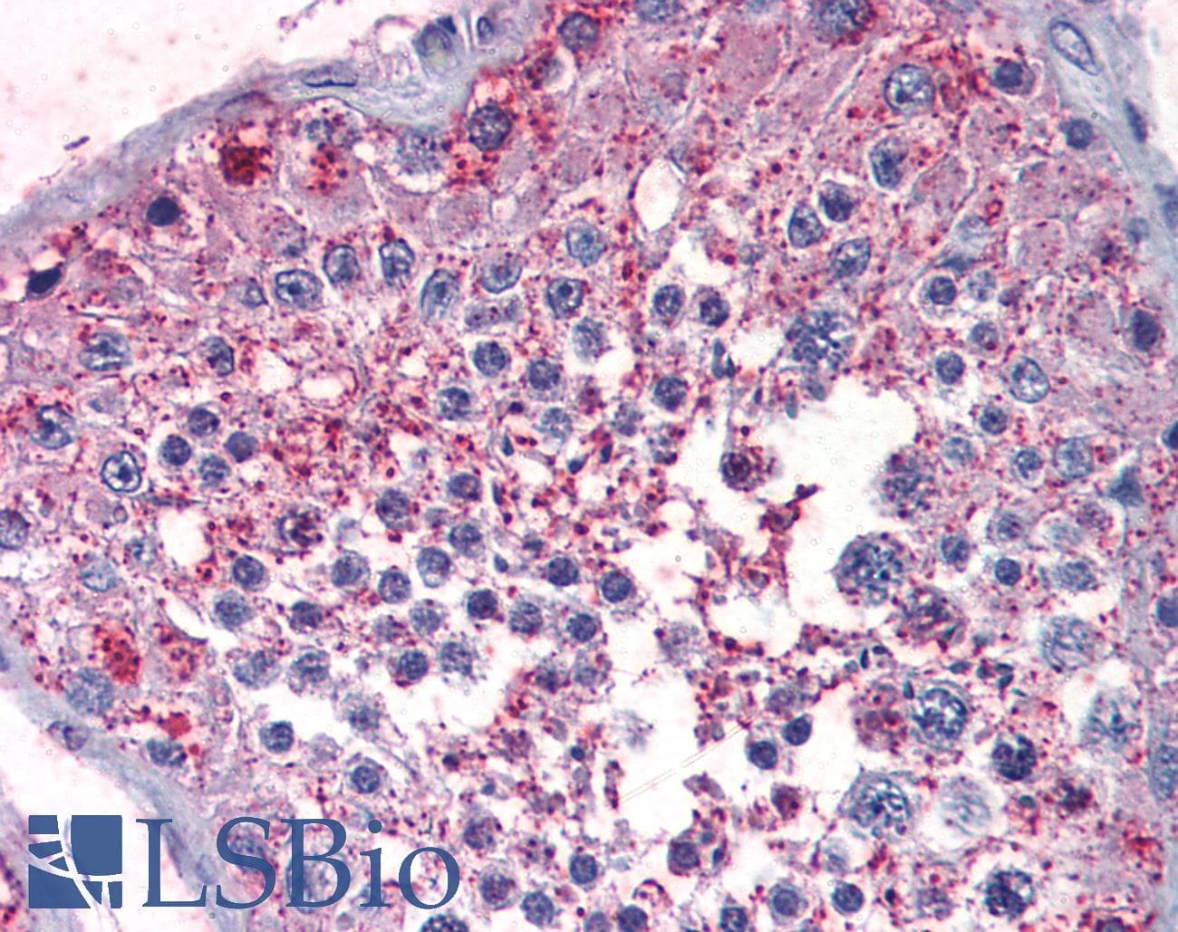 PathPlus™ PKD3 / PRKD3 Antibody (Internal)