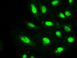 PMEL / SILV / gp100 Antibody (clone OTI8A4)